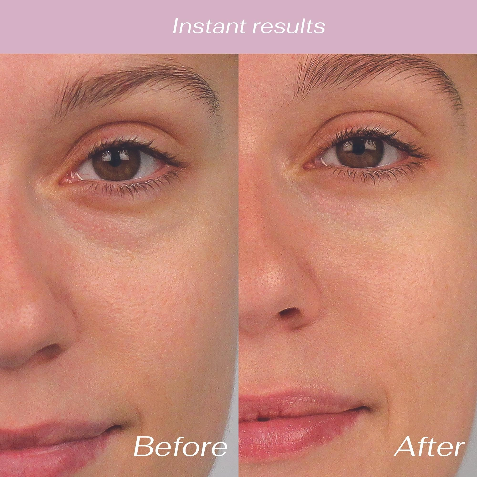 Lise Watier Lift Eye Patch - Plumping Hydrating Eye Treatment 6 Pairs - Image 6