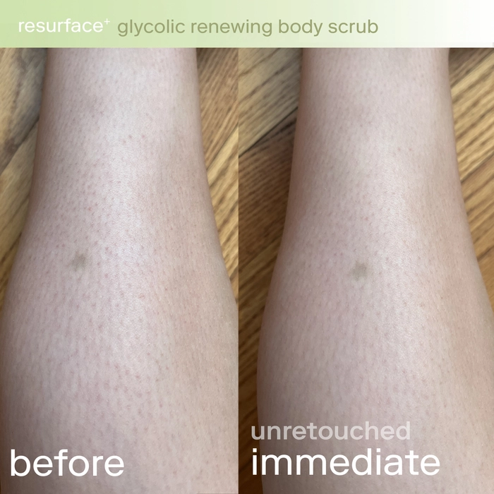 Skinfix Resurface+ Glycolic and Lactic Acid Renewing Body Scrub - Image 3