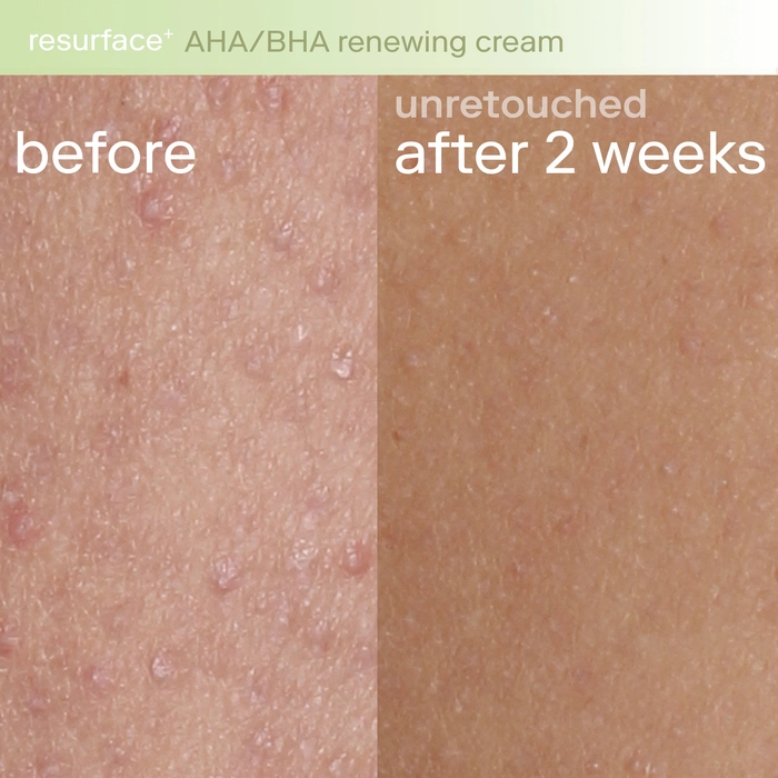 Skinfix Resurface+ AHA Renewing Body Cream - Image 2