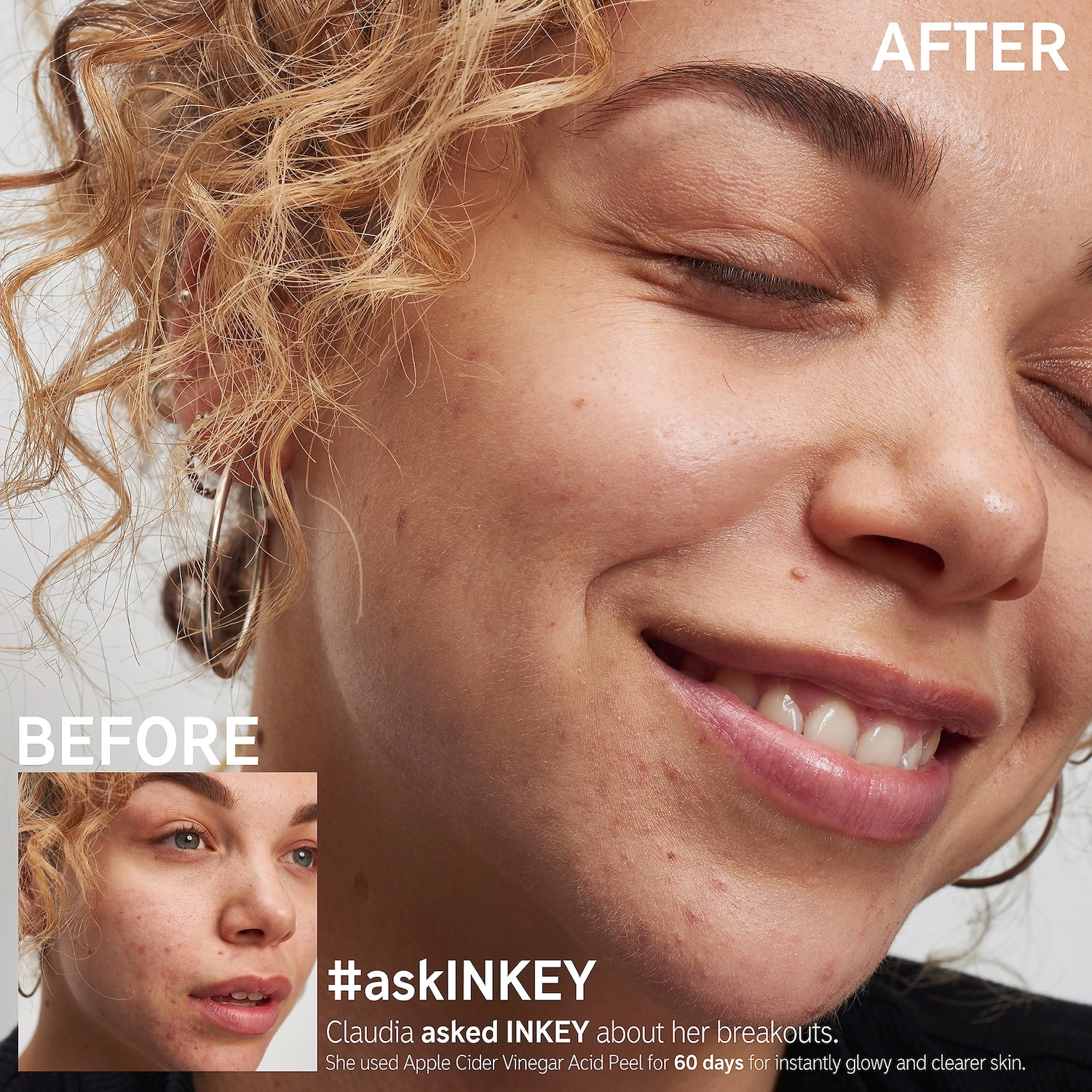 INKEY List Apple Cider Vinegar Acid Peel 1 oz/30 mL - Image 3