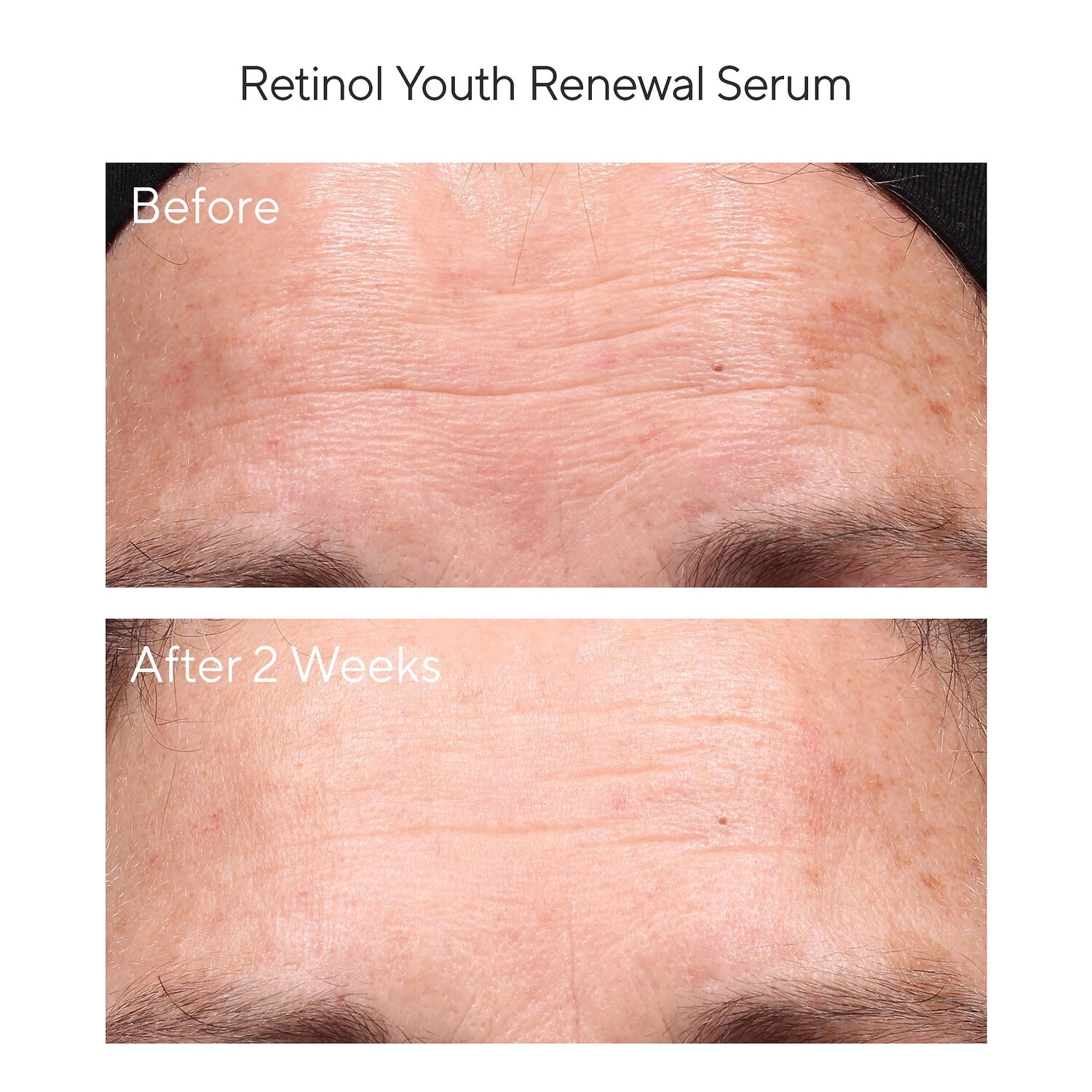 Murad Retinol Youth Renewal Serum - Image 14