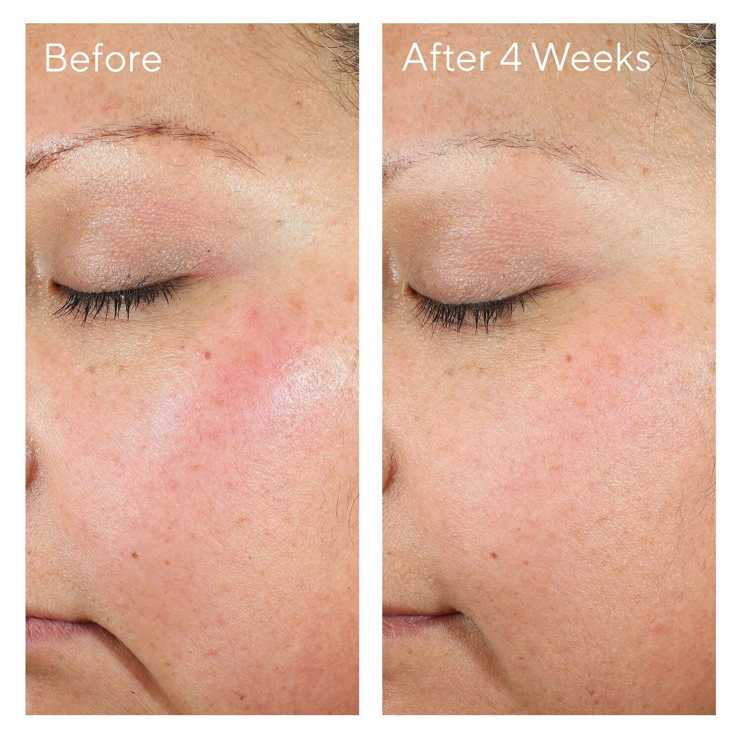 Murad Intense Recovery Cream 1.7 oz/50.2 mL - Hydrating Cream for Stressed-Out Skin - Image 7