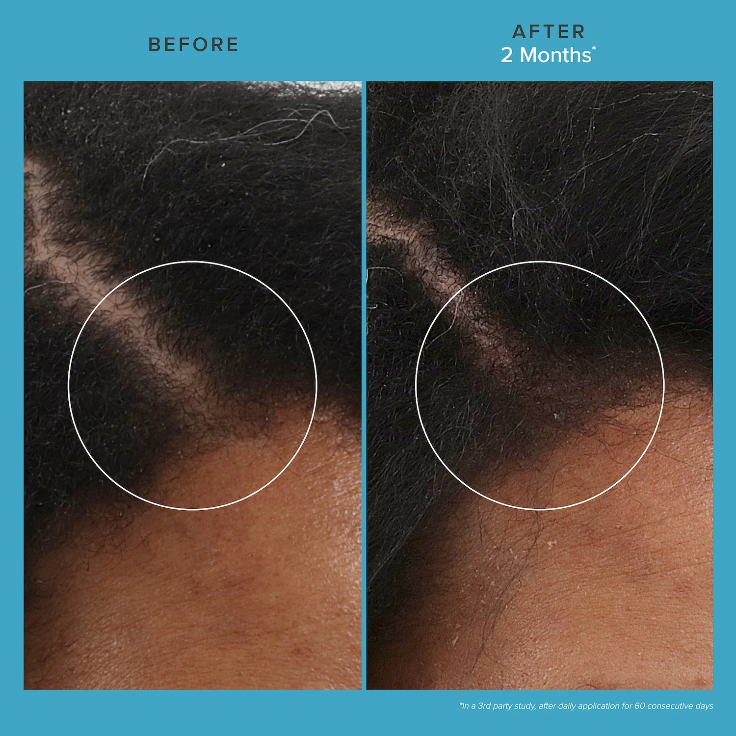 Living Proof Scalp Care Revitalizing Treatment 2.5 oz/72 mL Vegan Clean Hair Thinning Without Parabens Without Silicones - Image 3