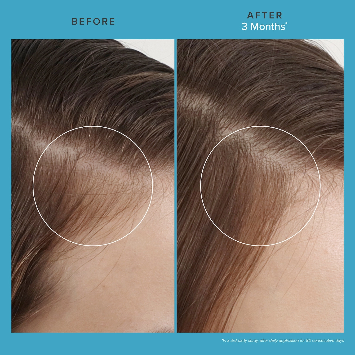 Living Proof Scalp Care Revitalizing Treatment 2.5 oz/72 mL Vegan Clean Hair Thinning Without Parabens Without Silicones - Image 4