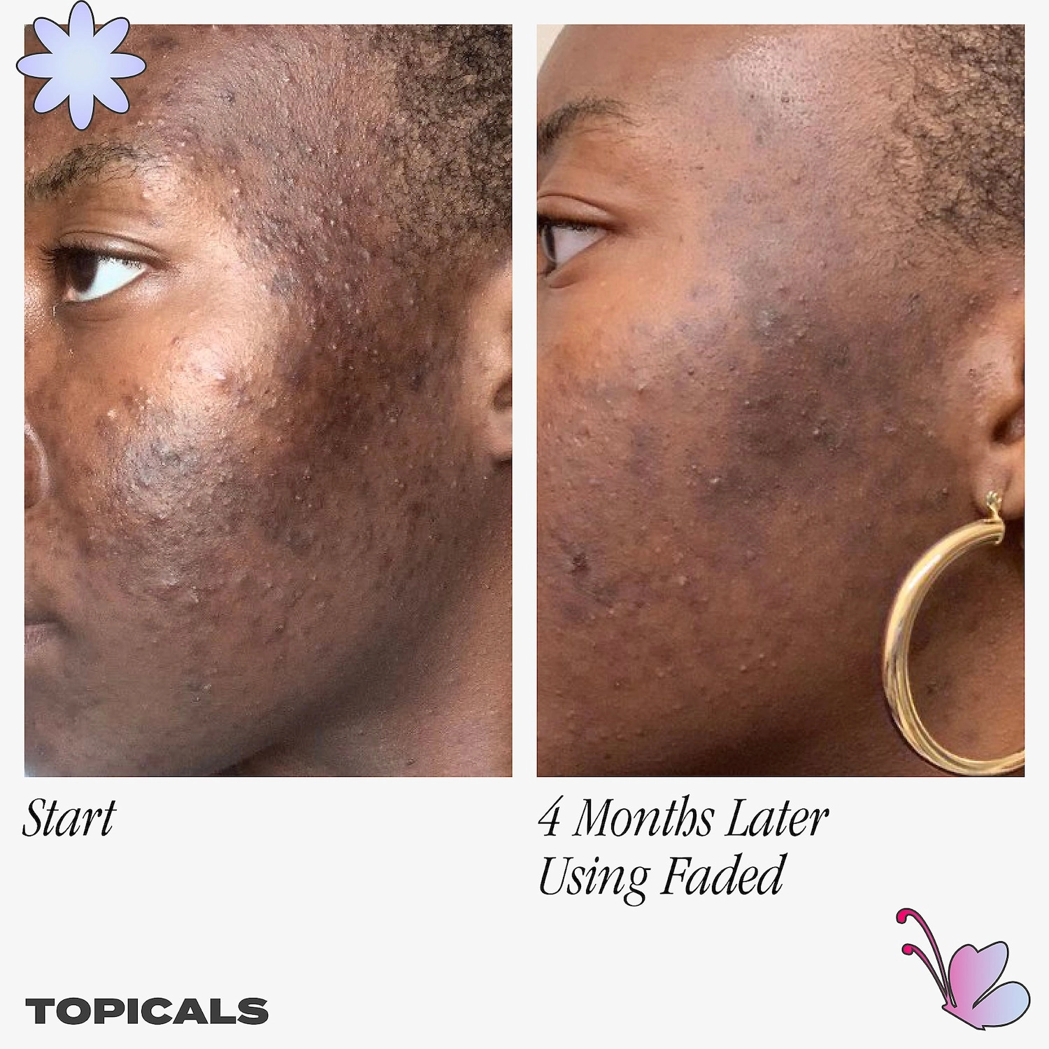 Topicals Faded Serum for Dark Spots & Discoloration - 1.7 oz/50 mL, Vegan - Image 4