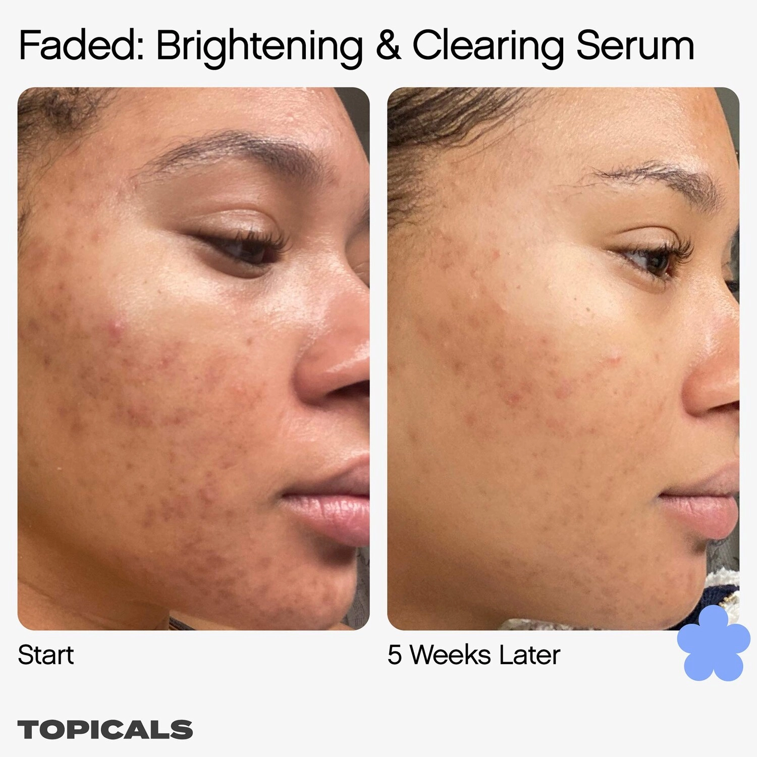 Topicals Faded Serum for Dark Spots & Discoloration - 1.7 oz/50 mL, Vegan - Image 10