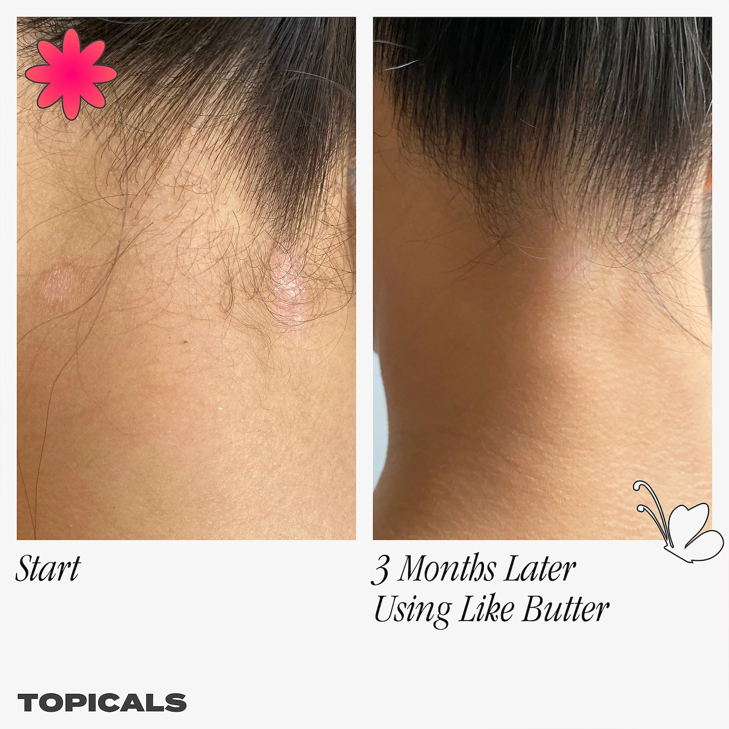 Topicals Like Butter Mask for Dry, Sensitive & Eczema-Prone Skin 1.7 oz/50 mL Vegan Hydrating Hyaluronic Acid Niacinamide - Image 4