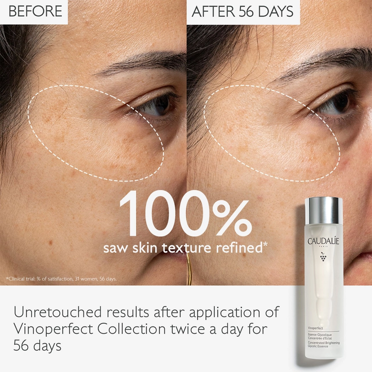 Caudalie Vinoperfect Brightening Glycolic Essence - Image 2