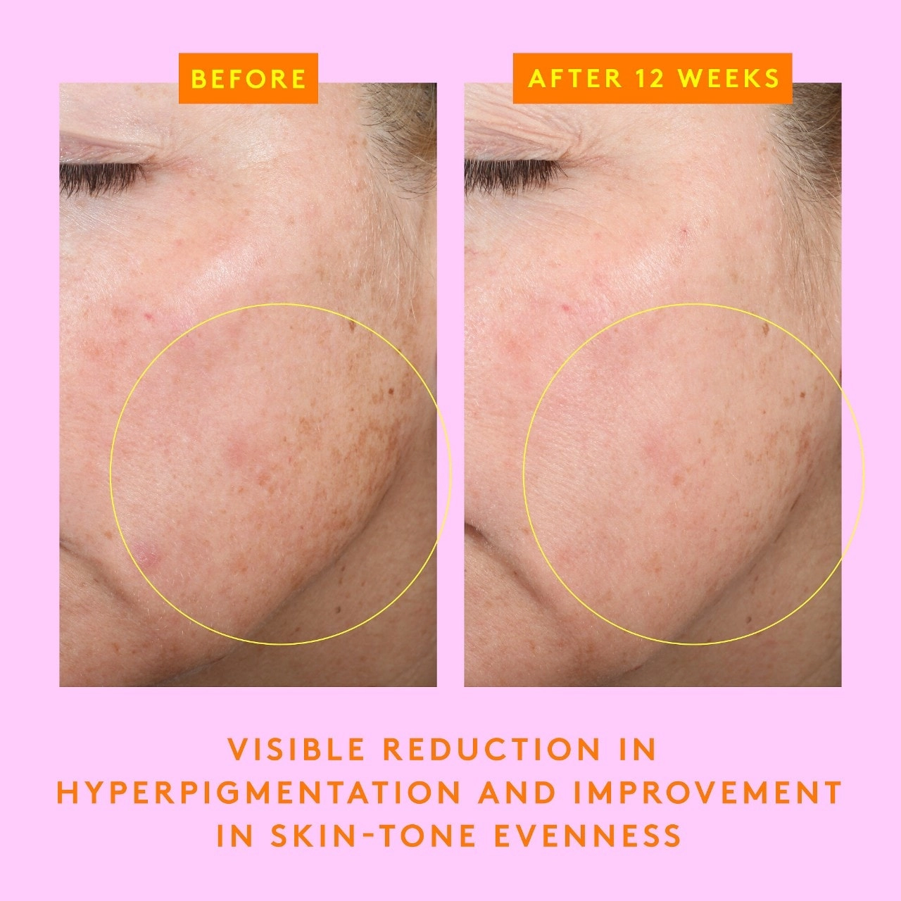 Drunk Elephant C-Firma Fresh Vitamin-C Day Serum - Size: 0.94 oz/28 mL - Image 3