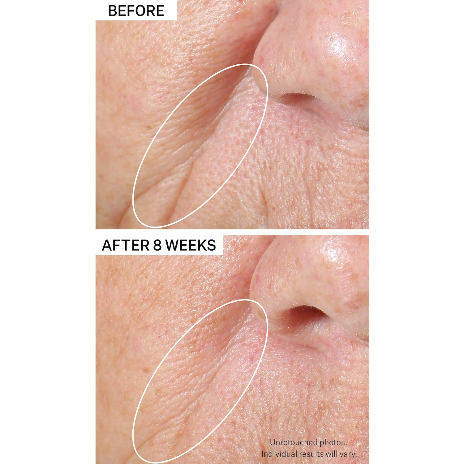 StriVectin Peptight ™ Tightening & Brightening Face Serum 1.7 oz/50 mL - Dark Spot Corrector, Firming and Anti-Aging - Image 5