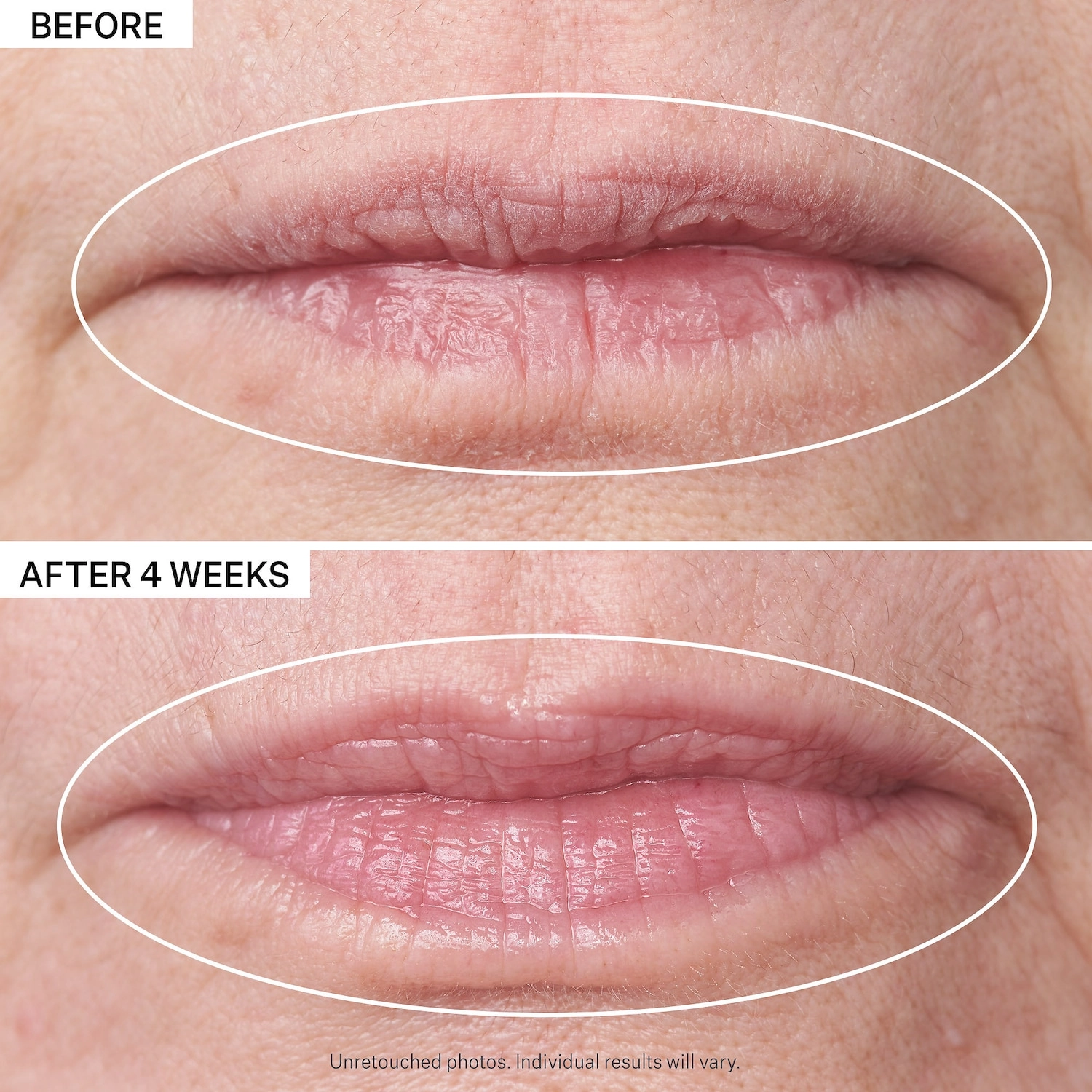 StriVectin Double Fix™ for Lips Plumping & Vertical Line Treatment 0.16 oz/3.8 mL Hyaluronic Acid - Image 4