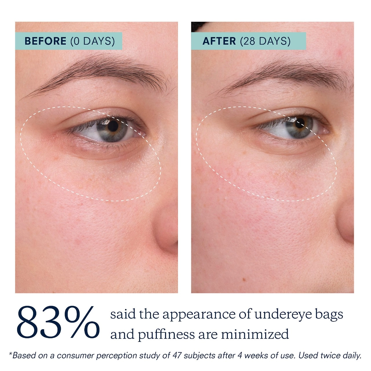 KORA Organics Berry Bright Firming Vitamin C Eye Cream 0.5 oz/15 mL Refillable Vegan - Image 3