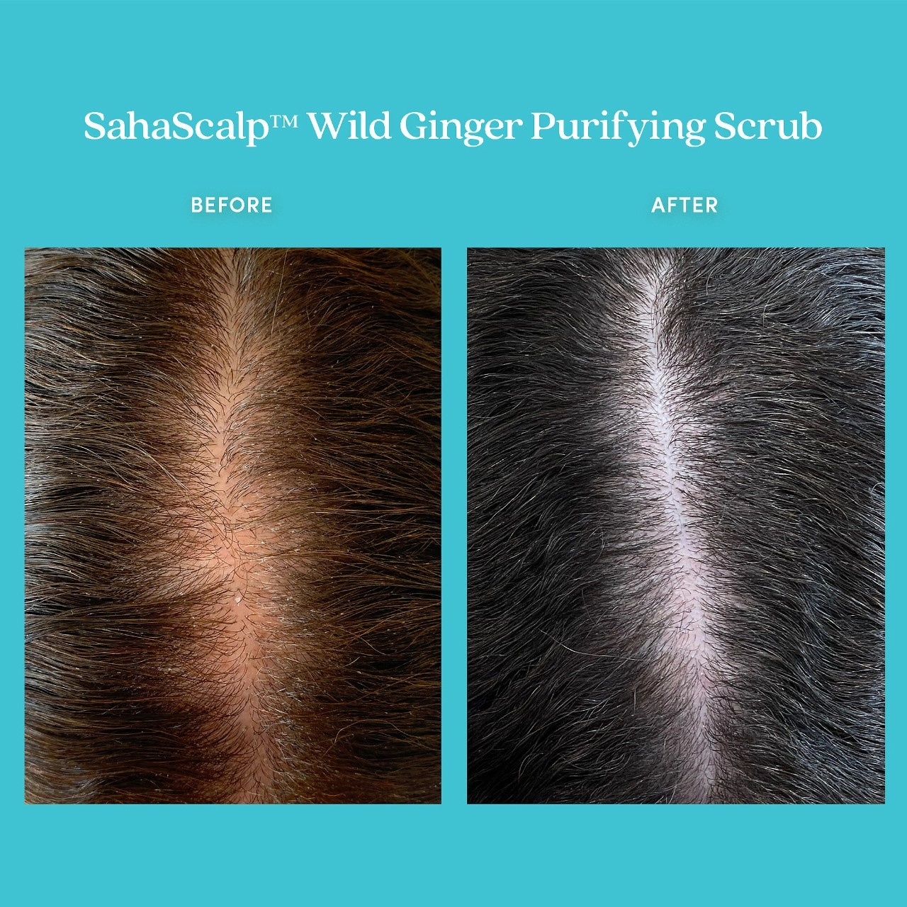 Fable & Mane SahaScalp Wild Ginger Purifying Scrub 8 oz/237 mL Vegan - Image 2