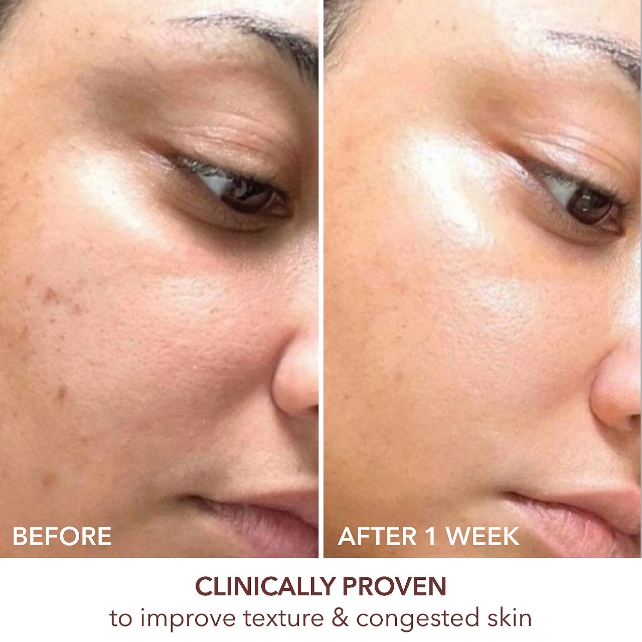 Dr. Dennis Gross Skincare Advanced Retinol + Ferulic Texture Renewal Serum 1 oz/30 mL - Image 2