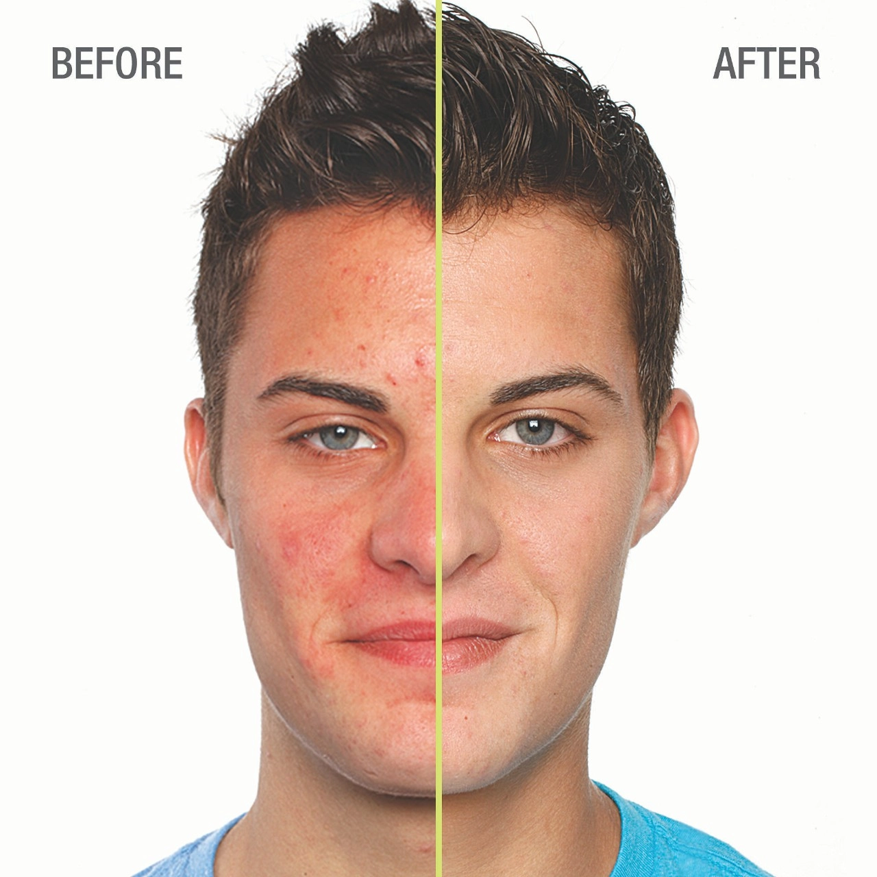 Juice Beauty BLEMISH CLEARING™ Solutions Kit - Image 7