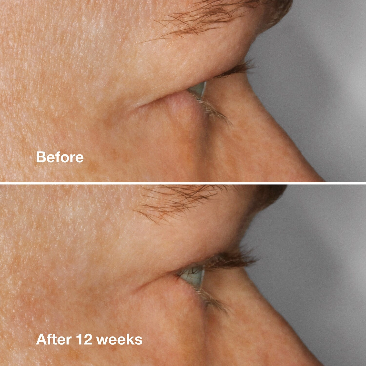 CLINIQUE High Impact™ Lash Amplifying Serum - Volumizing, Lengthening, Hyaluronic Acid, Fragrance-Free, Paraben-Free - Image 3