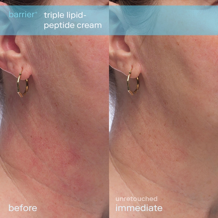 Skinfix Barrier+ Triple Lipid-Peptide Refillable Face Cream 0.5 oz/ 15 mL - Image 11