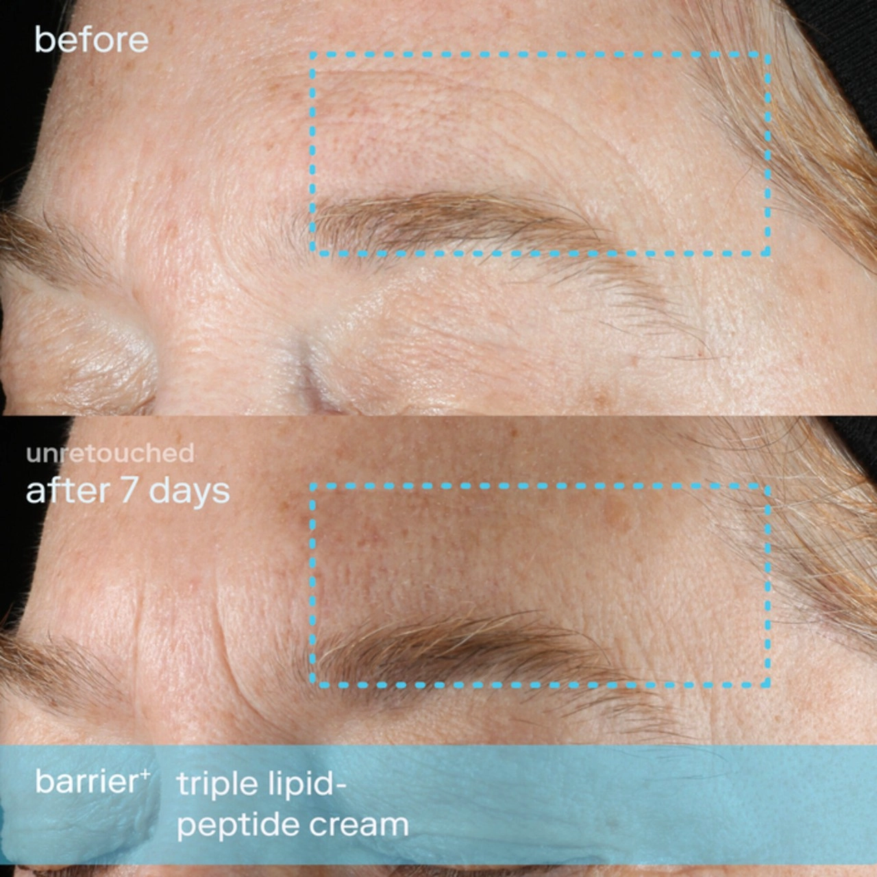 Skinfix Barrier+ Triple Lipid-Peptide Refillable Face Cream 0.5 oz/ 15 mL - Image 17
