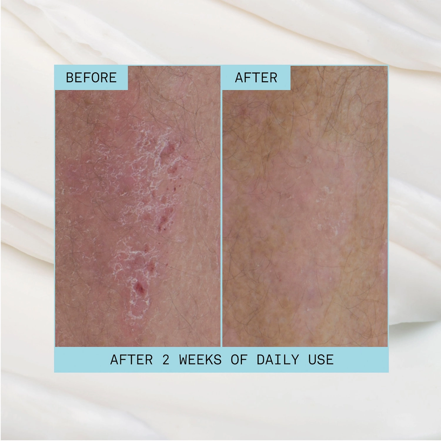 Josie Maran Intensive Daily Repair Body Butter 6 oz/ 170 g Fragrance Free Vegan Cruelty-Free - Image 7