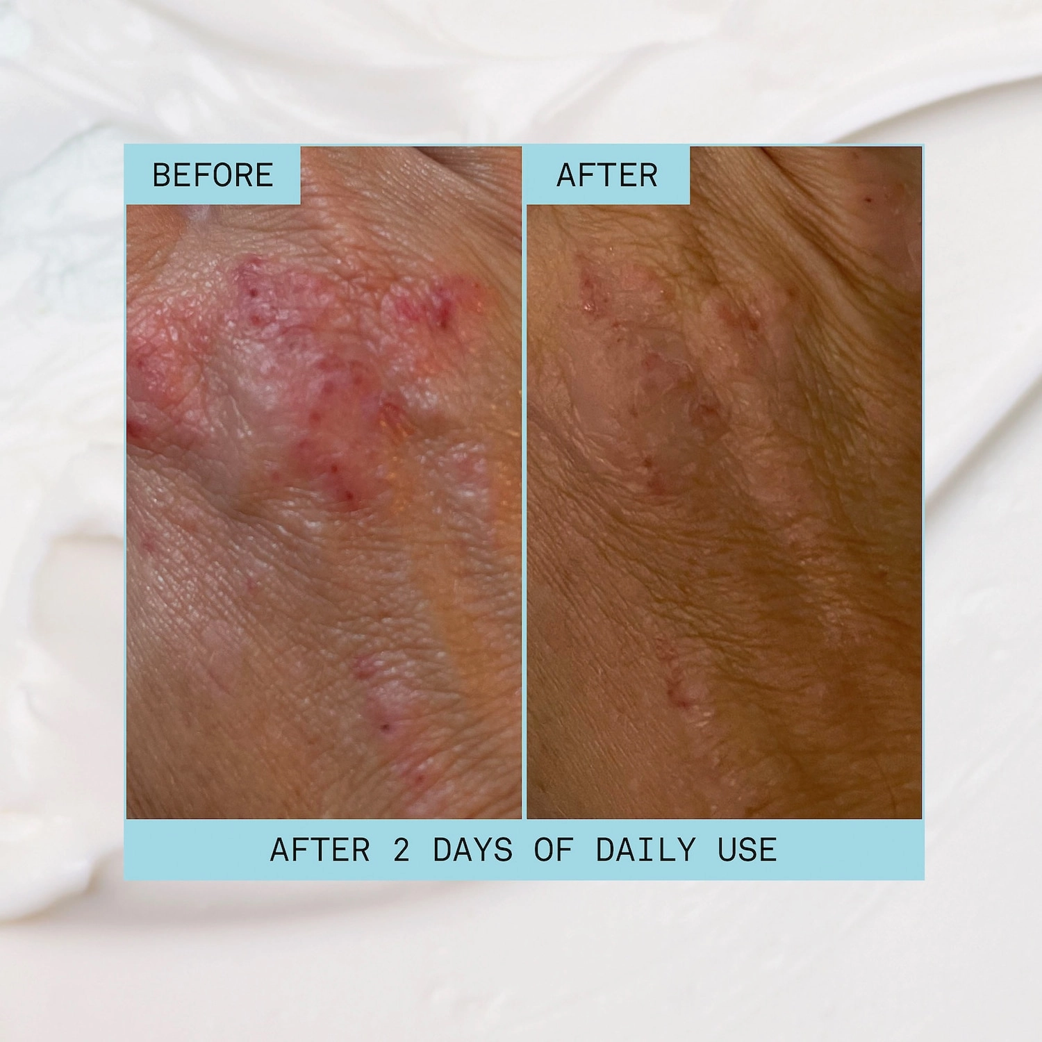 Josie Maran Intensive Daily Repair Body Butter 6 oz/ 170 g Fragrance Free Vegan Cruelty-Free - Image 8