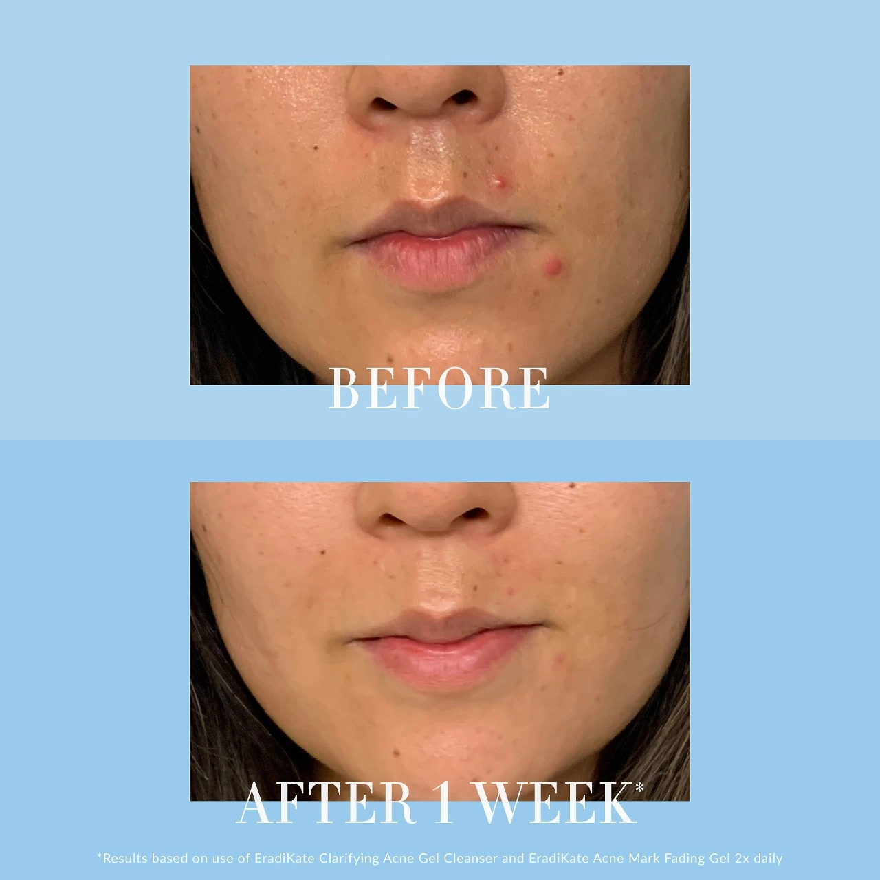 Kate Somerville EradiKate™ Clarifying Blemish Gel Cleanser with Salicylic Acid, Prebiotic Complex & Niacinamide 4 oz/120 mL - Image 3