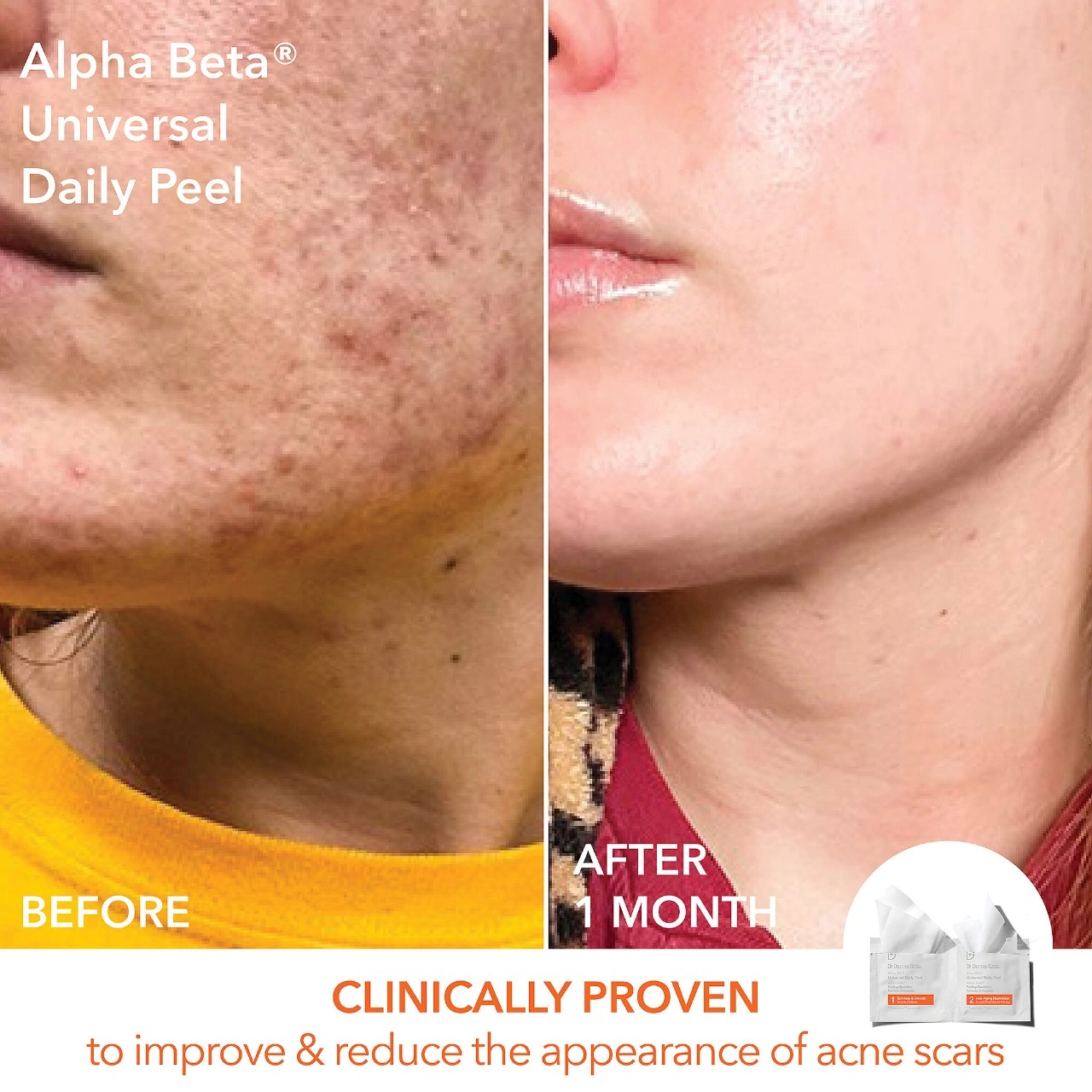 Dr. Dennis Gross Skincare Alpha Beta Daily Essentials - Universal - Image 10