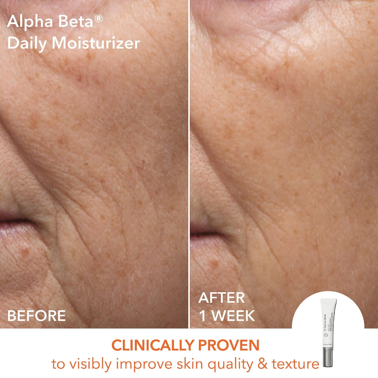 Dr. Dennis Gross Skincare Alpha Beta Daily Essentials - Universal - Image 7