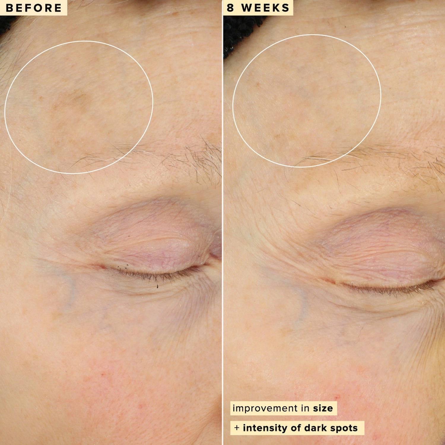 Farmacy 10% Waterless Vitamin C Serum - Size: 1 oz/30 mL - Good for Uneven Texture, Loss of Firmness, and Dark Spots - Image 7