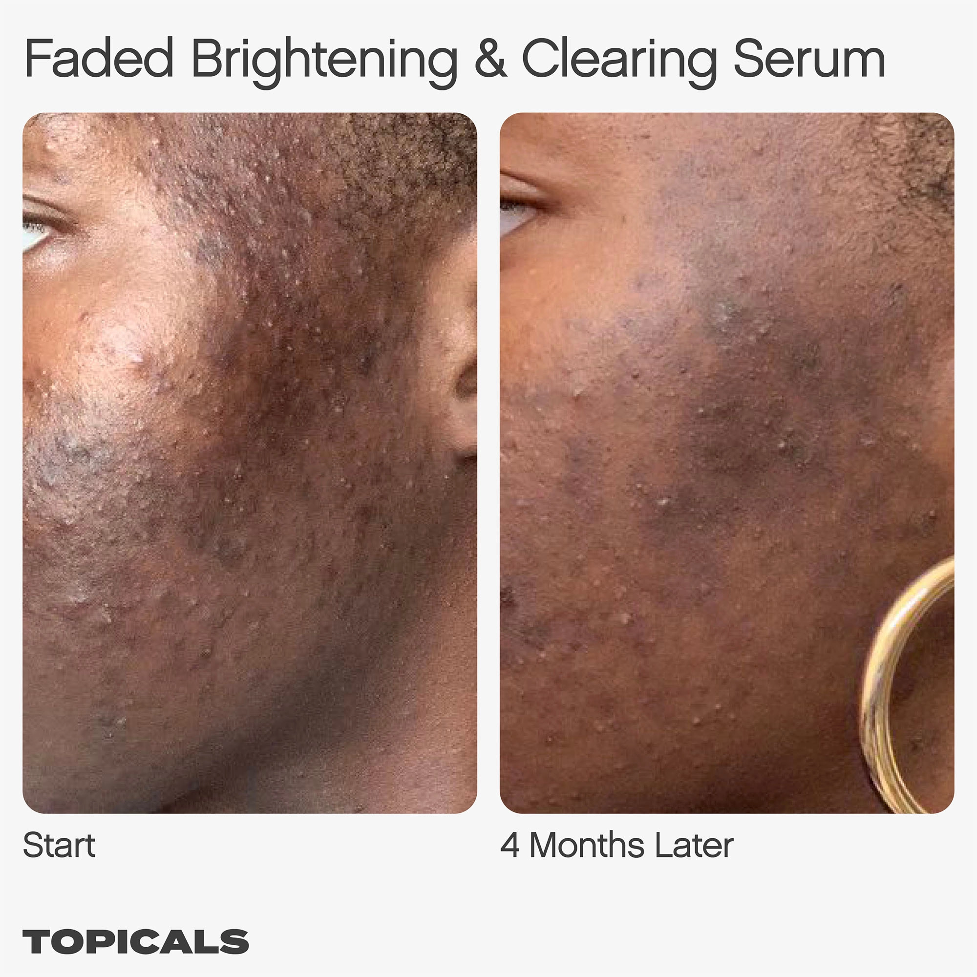 Topicals Faded Serum for Dark Spots & Discoloration 0.5/15 Vegan Clean - Image 5