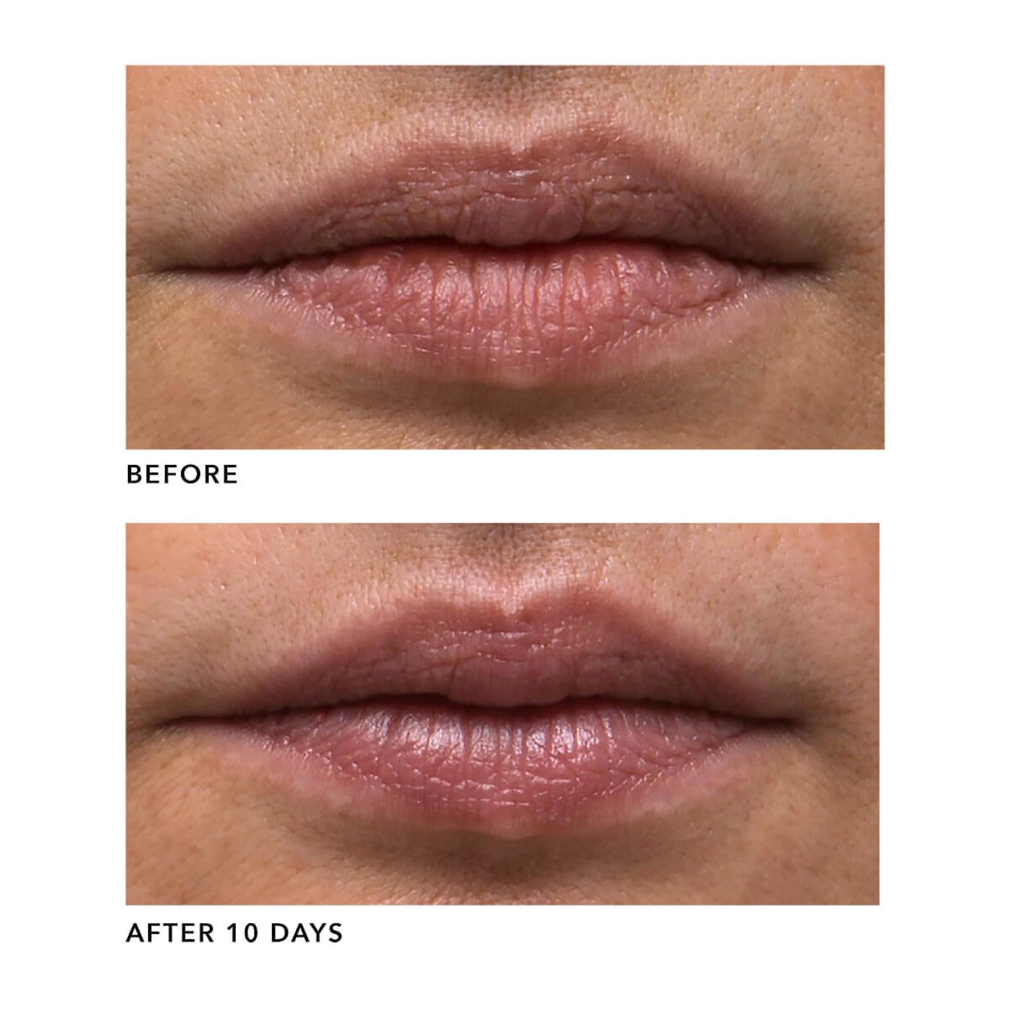 Algenist GENIUS Liquid Collagen Lip Treatment 0.5 oz / 15 mL Vegan Plumping Lip Serum - Image 2
