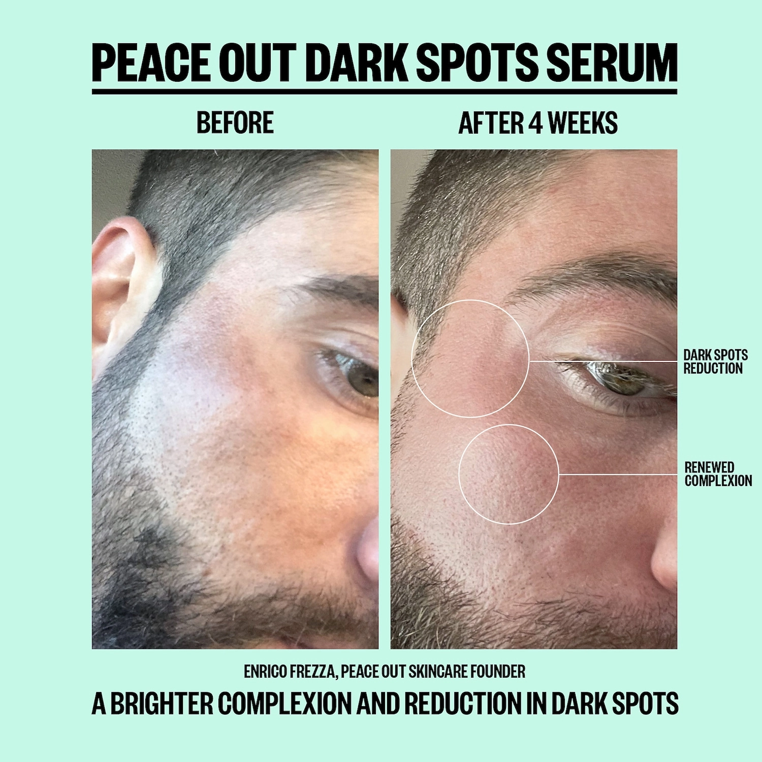 Peace Out Dark Spots Serum 1 oz/ 30 mL Vegan AHA/Glycolic Acid Dark spots - Image 3