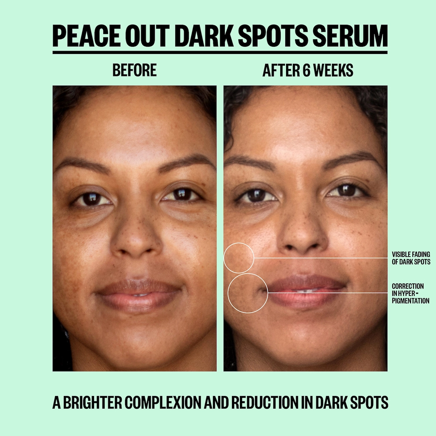 Peace Out Dark Spots Serum 1 oz/ 30 mL Vegan AHA/Glycolic Acid Dark spots - Image 4