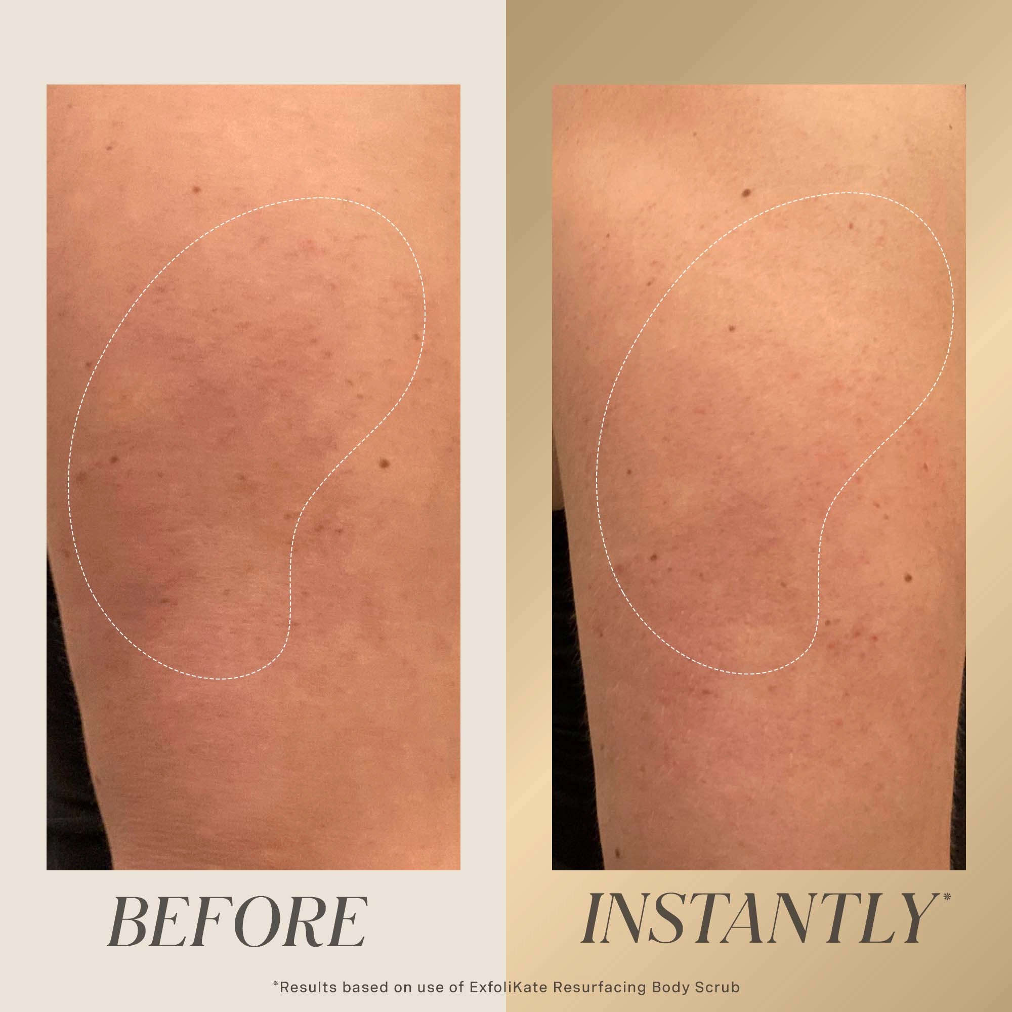 Kate Somerville ExfoliKate™ All Over Glow Kit - Image 5