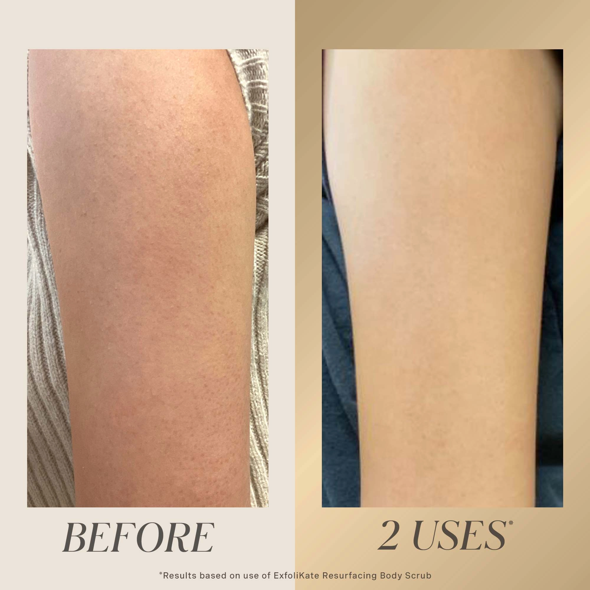 Kate Somerville ExfoliKate™ All Over Glow Kit - Image 6