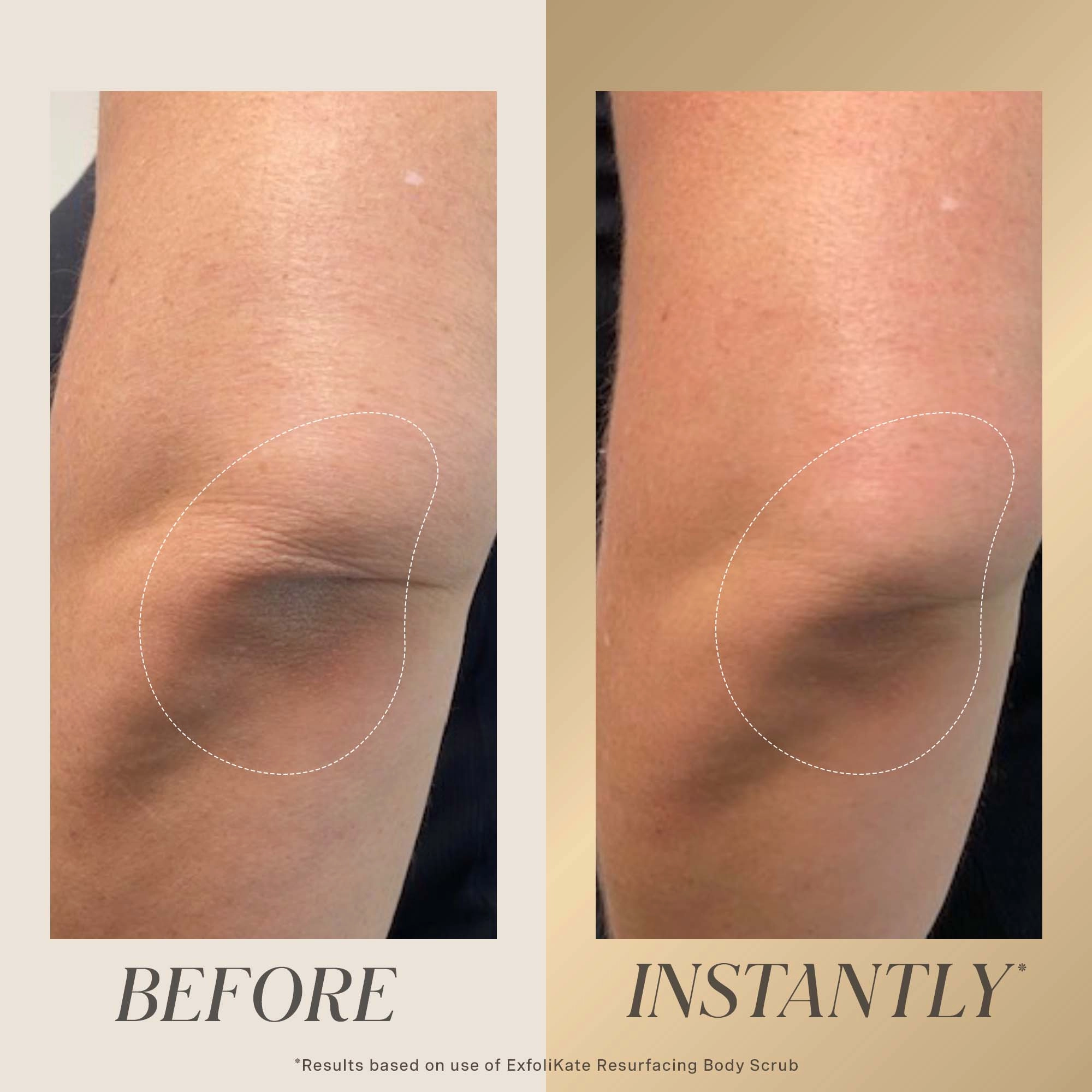 Kate Somerville ExfoliKate™ All Over Glow Kit - Image 7