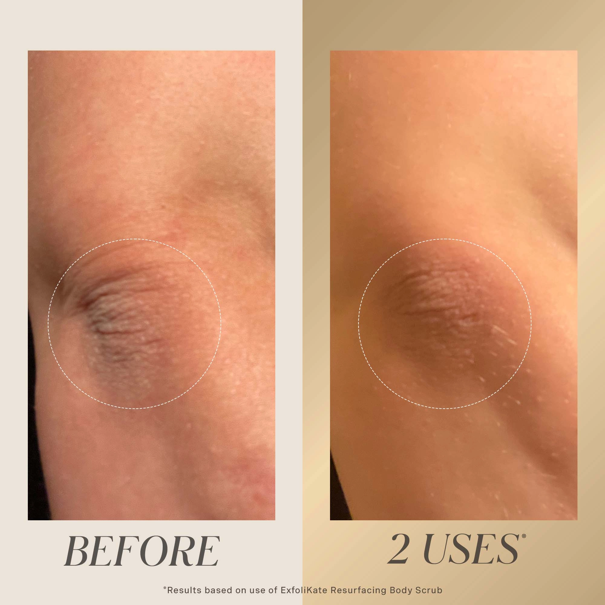 Kate Somerville ExfoliKate™ All Over Glow Kit - Image 8