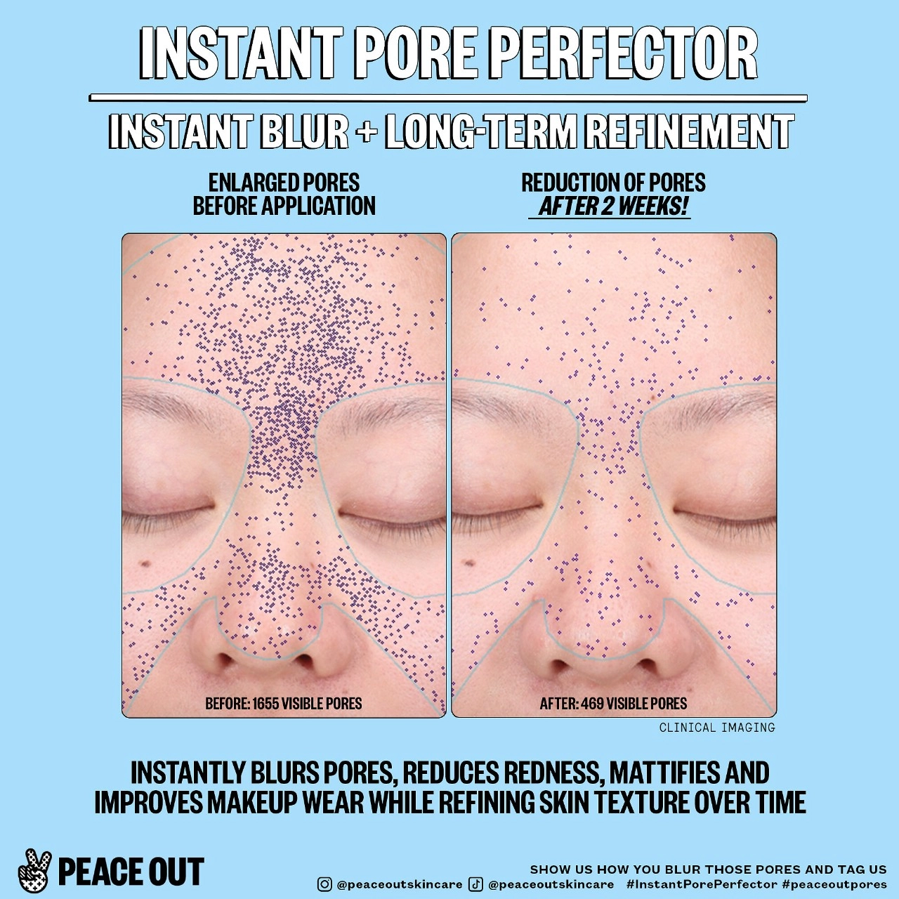 Peace Out Instant Pore Perfector 0.8 oz / 23 g Vegan Niacinamide - Image 5