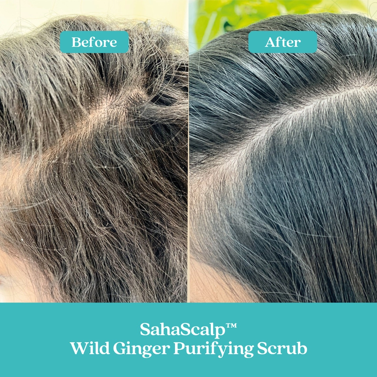 Fable & Mane SahaScalp Scalp Reset Kit - Image 3