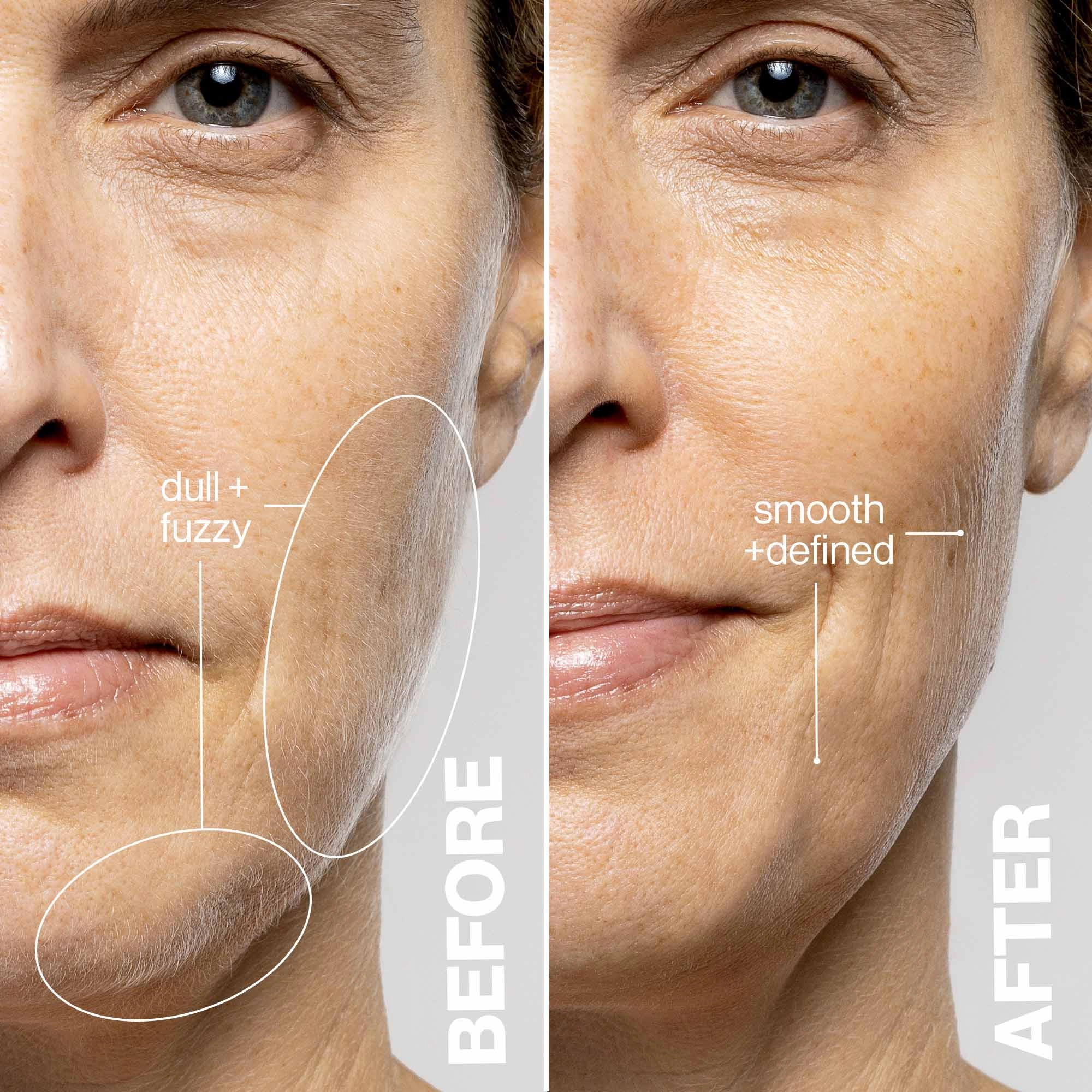 DERMAFLASH LUXE+ Advanced Sonic Dermaplaning + Peach Fuzz Removal - Blush Pink Vegan - Image 3