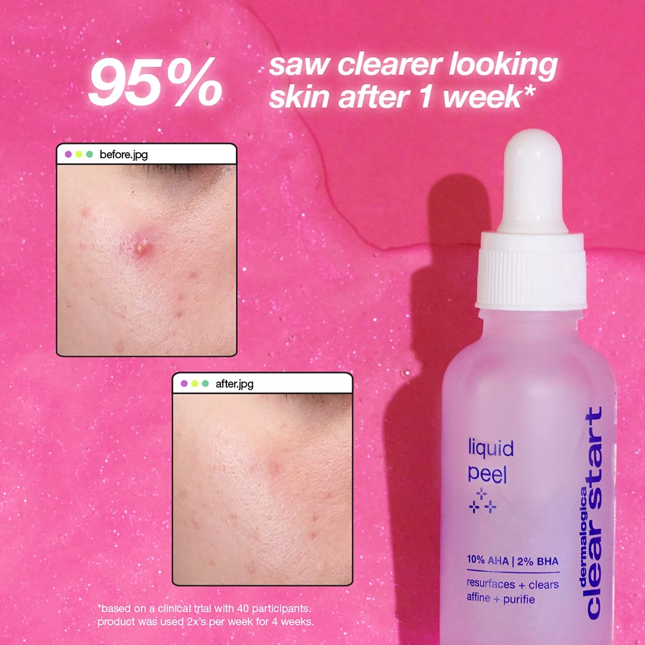 Dermalogica Clear Start Liquid Peel 1 oz / 30 mL - Image 7