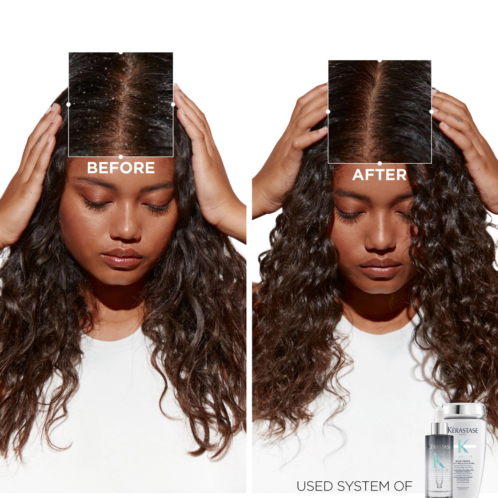 Kérastase Symbiose Deeply Hydrating Hair Mask for Damaged Hair 6.8 oz / 200 mL - Image 2