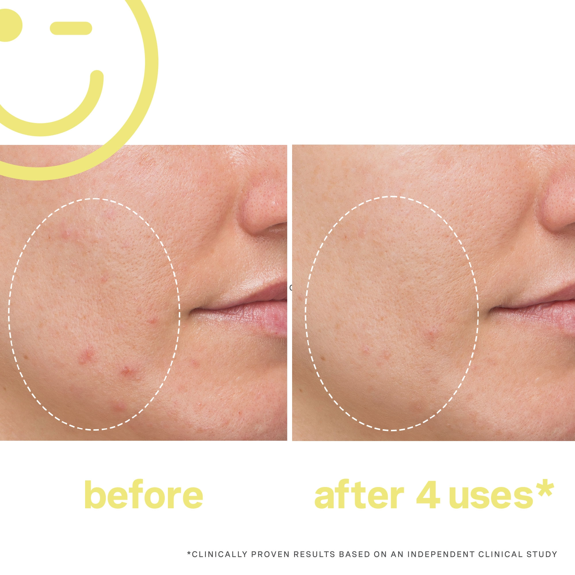 Kate Somerville MEGA-C™ 30% Vitamin C Brightening Mask - 2 oz / 60 mL Cream Formula - Image 2