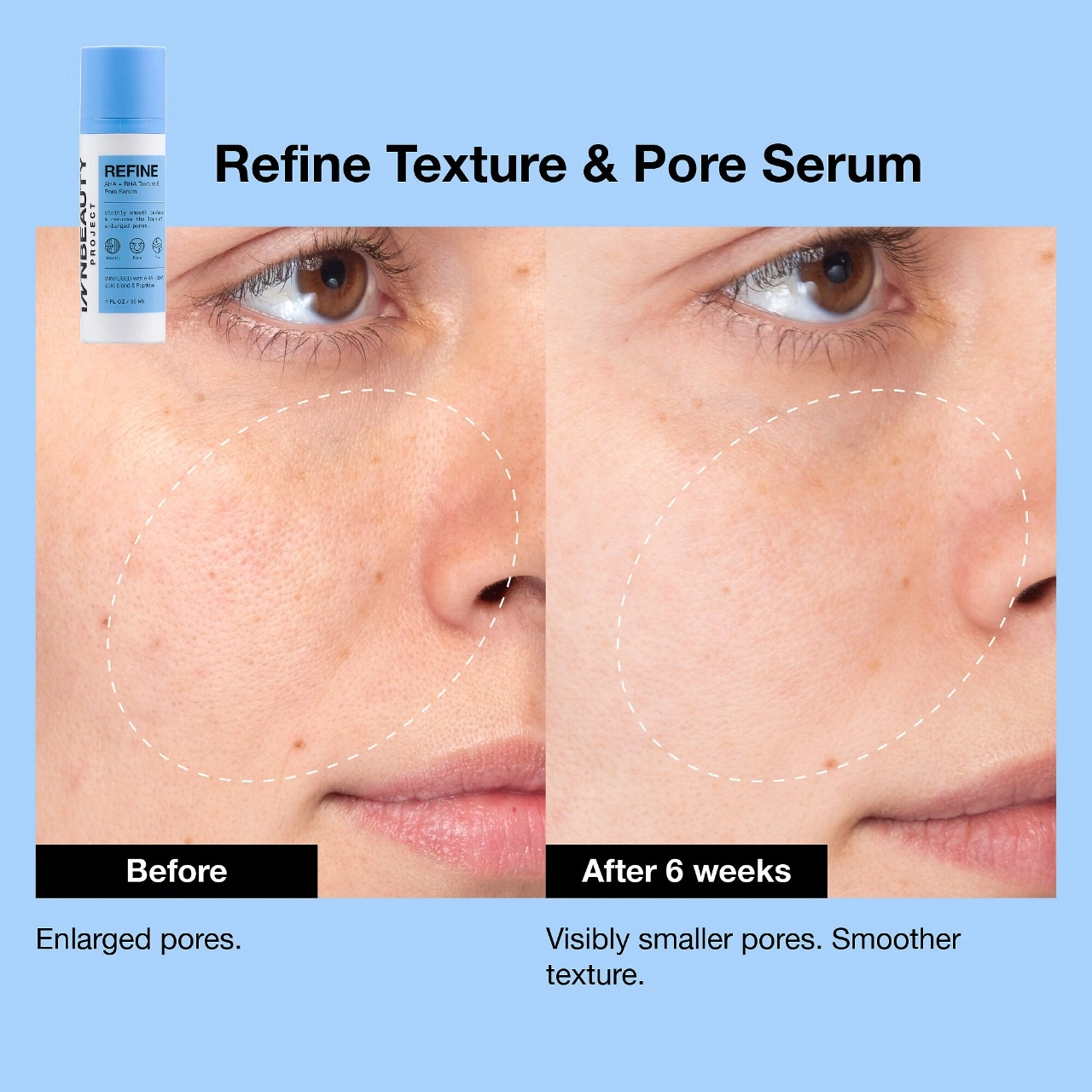 iNNBEAUTY PROJECT Refine AHA + BHA Texture & Pore Serum 1 oz / 30 mL - Image 4