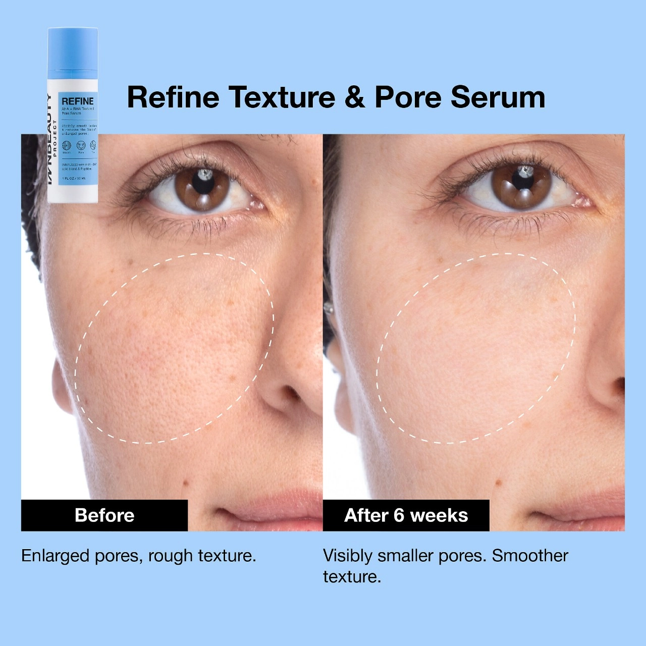 iNNBEAUTY PROJECT Refine AHA + BHA Texture & Pore Serum 1 oz / 30 mL - Image 5