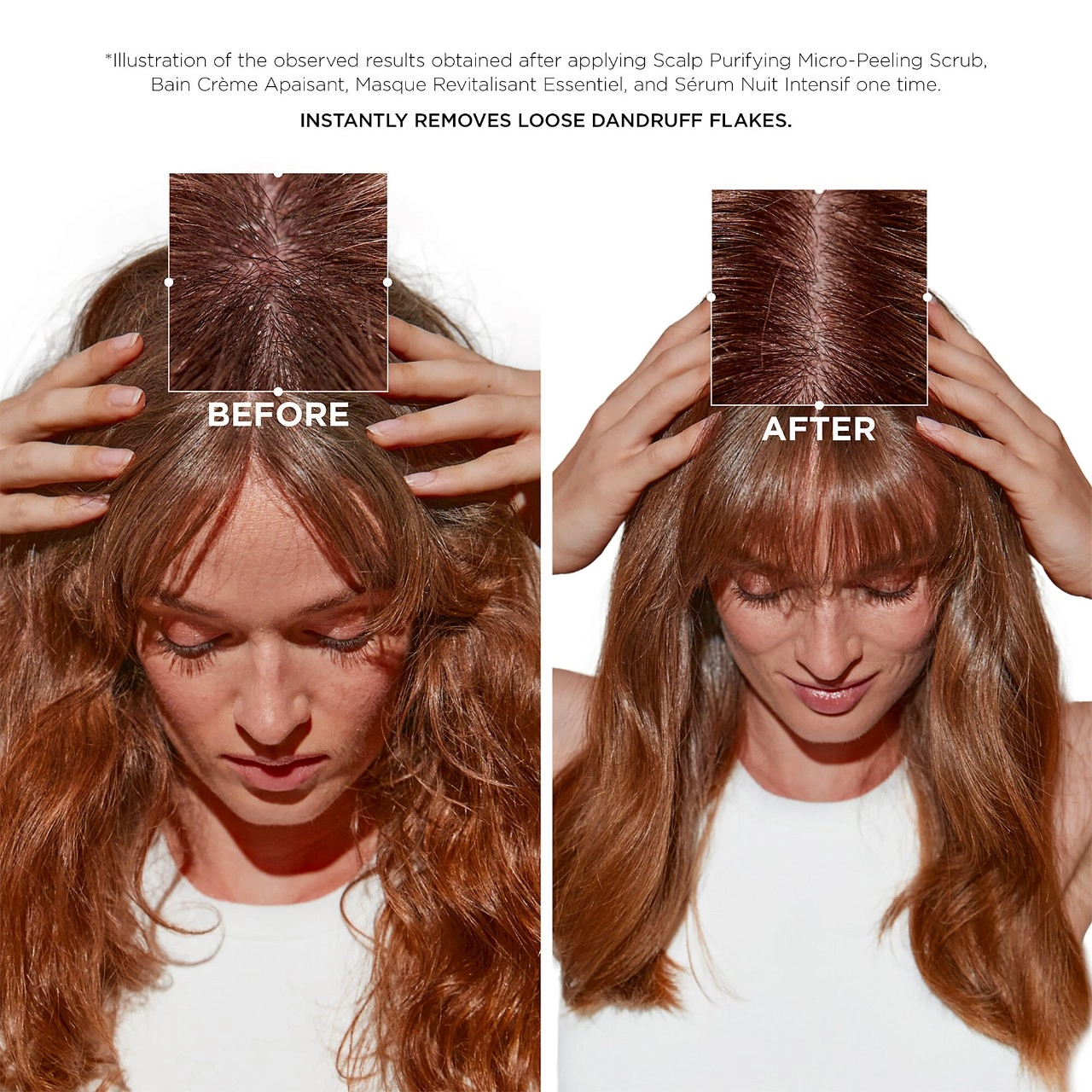 Kérastase Symbiose Scalp Purifying Micro-Peeling Scrub 6.8 oz / 200 mL Hydrating Fresh Scent All Hair Types - Image 3