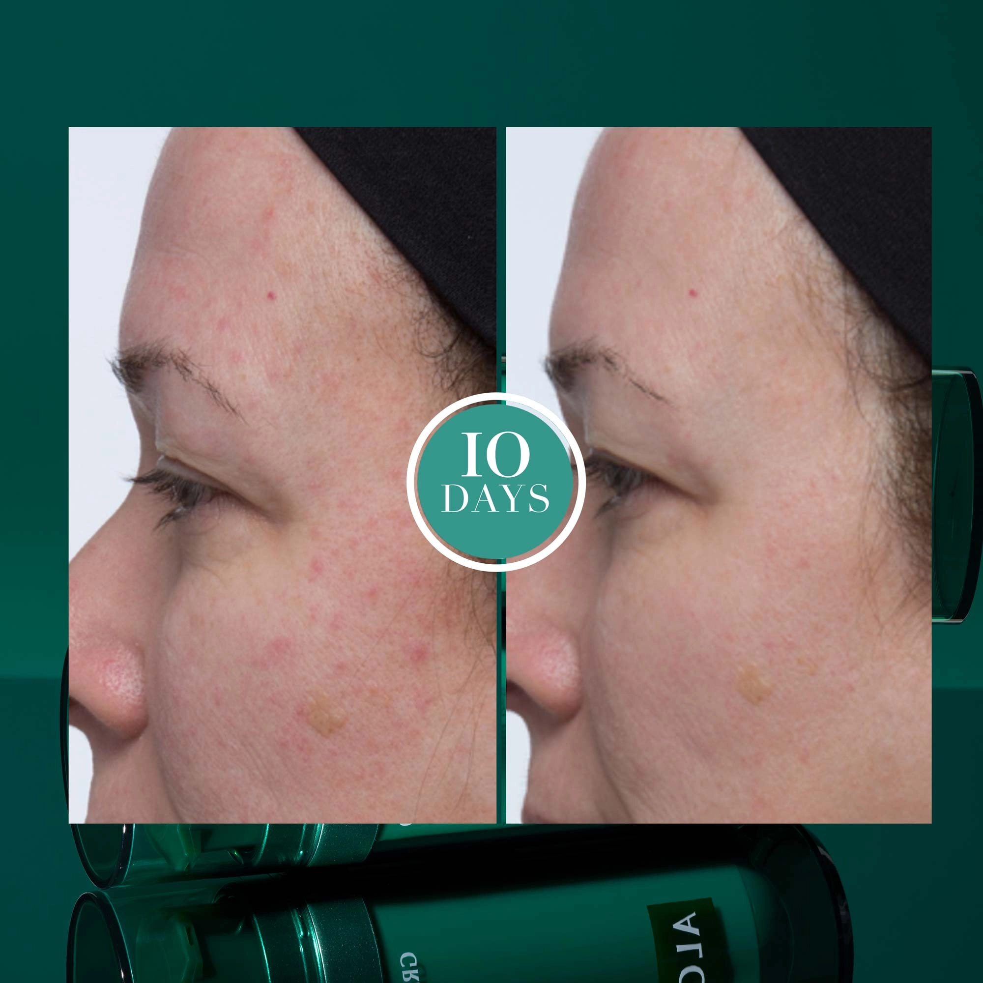 Algenist Green Microalgae Retinol + Regenerating Serum 1 oz / 30 mL Vegan Hydrating Retinol AHA/Glycolic Acid Fragrance Free - Image 3