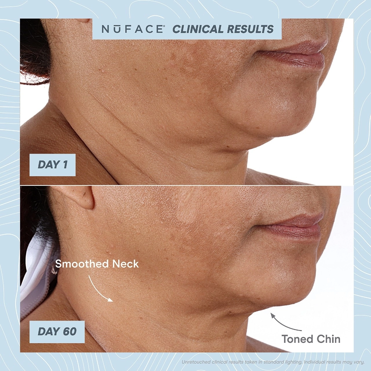 NuFACE Trinity+® Starter Kit - Hyaluronic Acid, Anti-Aging, Oil-Free - Image 5