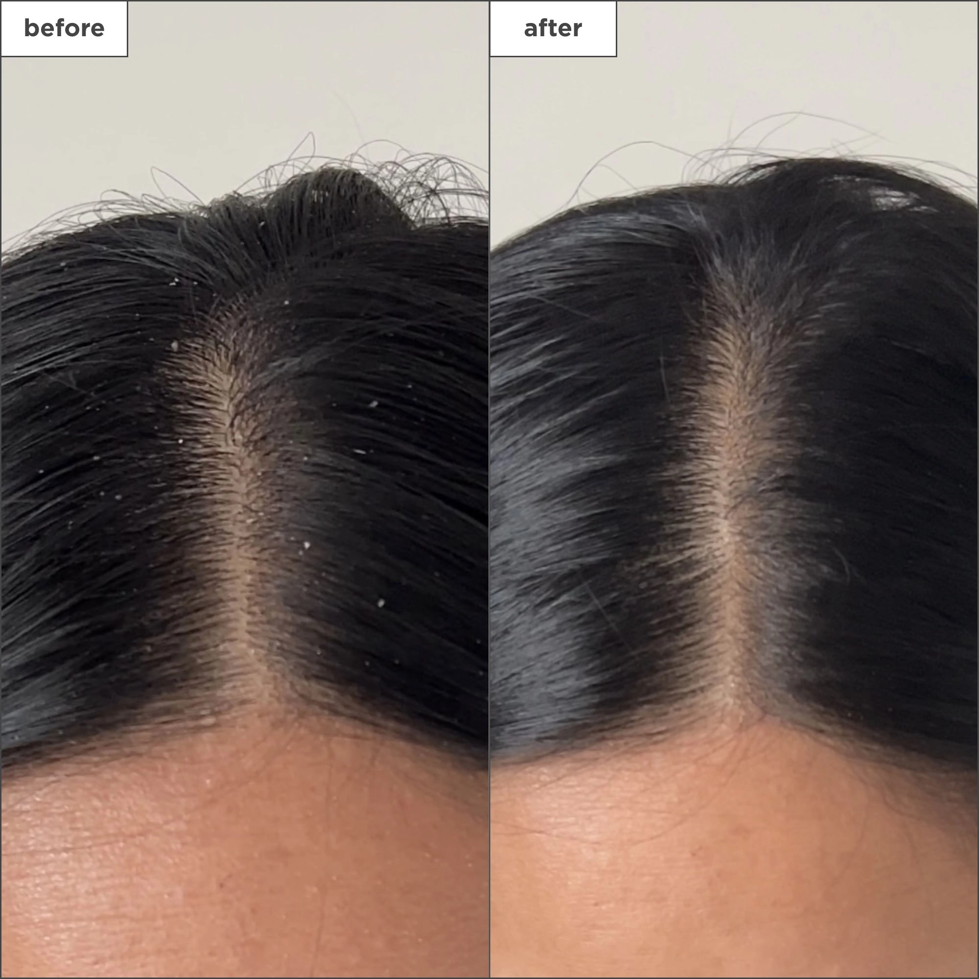Briogeo Scalp Revival™ Charcoal + Tea Tree Buildup Detox Spray 4 oz / 120 ml Vegan - Image 2
