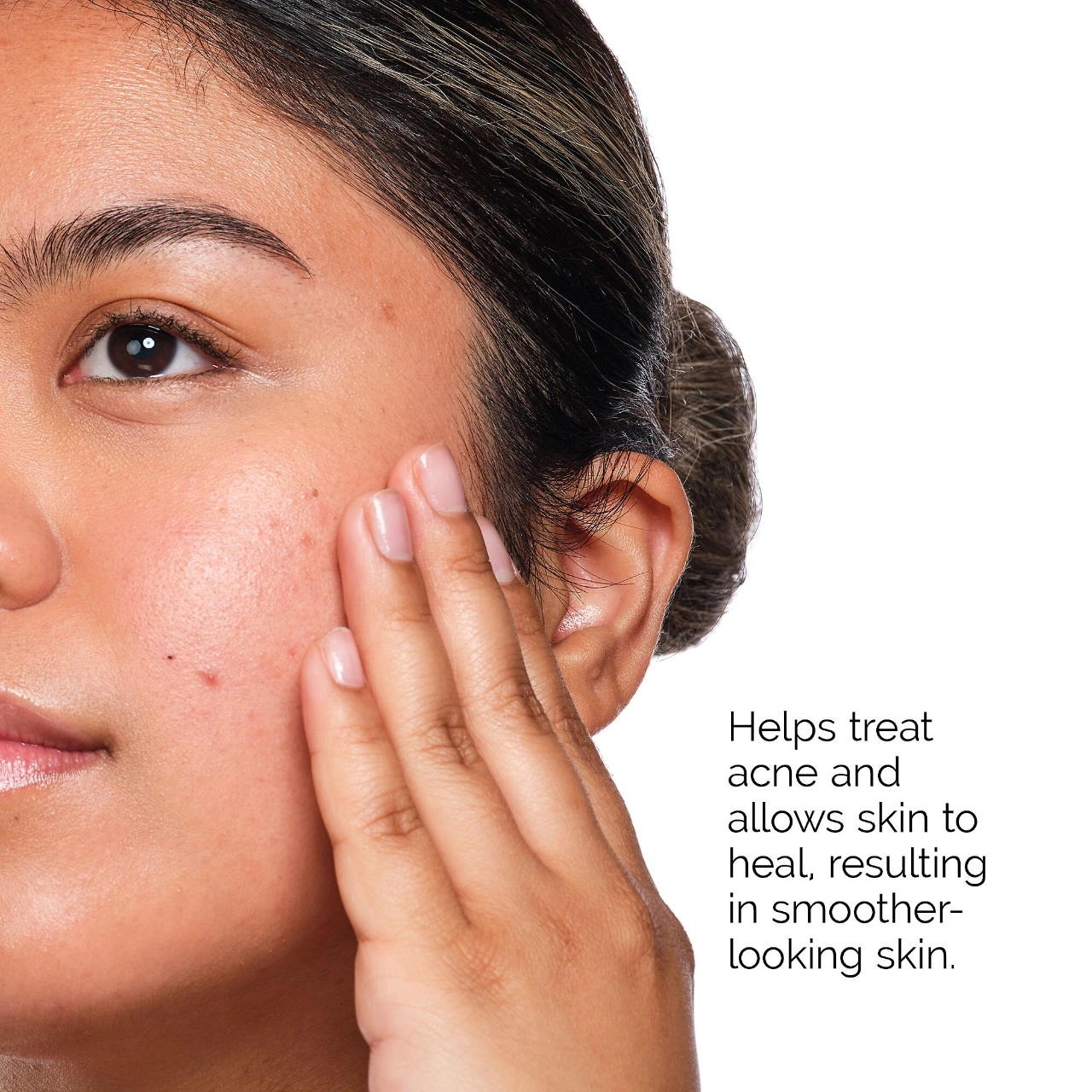 The Ordinary Acne Set - Glucoside Foaming Cleanser, Salicylic Acid 2%, Natural Moisturizing Factors + HA - Image 4