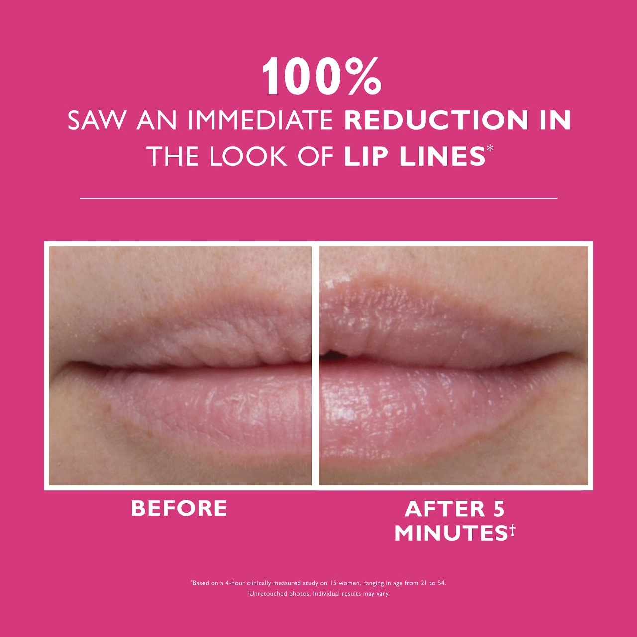 Peter Thomas Roth Instant FIRMx® Lip Filler - Plumping Hyaluronic Acid - 0.3 fl oz / 10 mL - Image 3